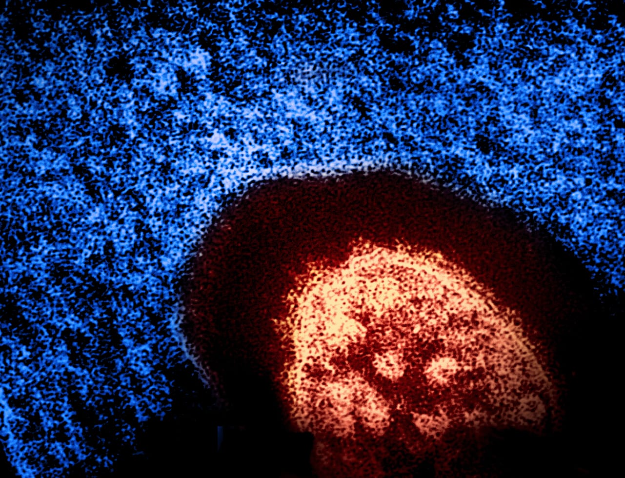 Uplifting Wellness: On Measles, Stress & Hantavirus