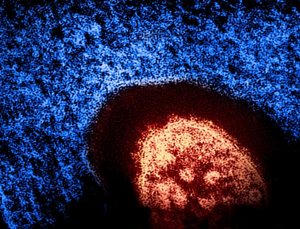 Uplifting Wellness: On Measles, Stress & Hantavirus